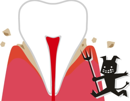 キシリトールガムの虫歯予防は効果は？
